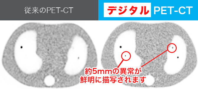 従来のPET-CTとの画像比較