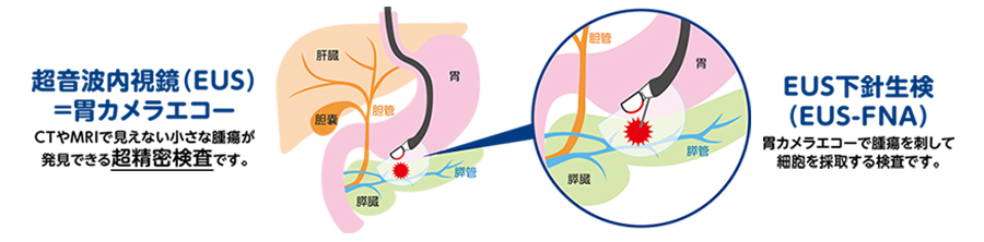 EUC図解