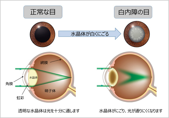 かわ にし 眼科