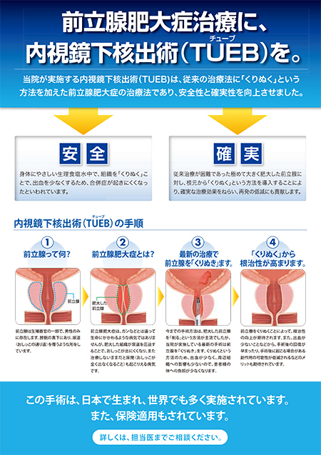 経尿道的前立腺核出術：TUEB（チューブ）